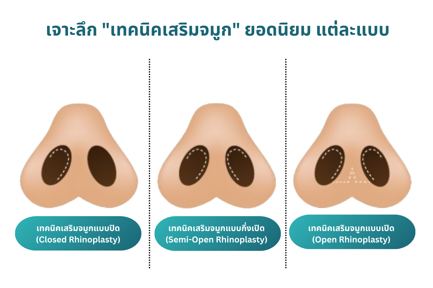 เจาะลึก 
